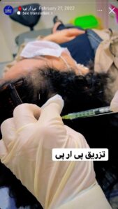 نمونه کار پی آر پی دکتر خوش نظر در ساری