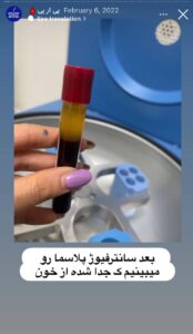 نمونه کار پی آر پی دکتر خوش نظر در ساری