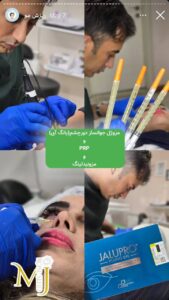 نمونه کار تزریق پی آر پی کلینیک رز سفید در ساری