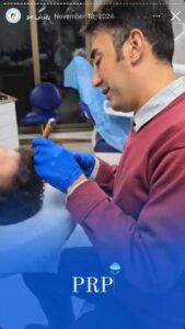 نمونه کار تزریق پی آر پی کلینیک رز سفید در ساری