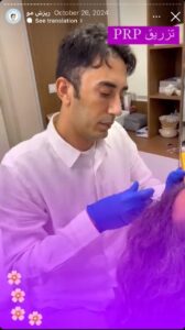نمونه کار تزریق پی آر پی کلینیک رز سفید در ساری
