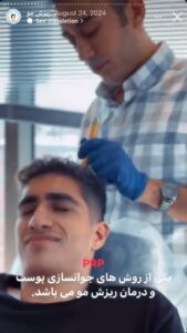 نمونه کار تزریق پی آر پی کلینیک رز سفید در ساری