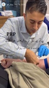 نمونه کار تزریق پی آر پی کلینیک رز سفید در ساری