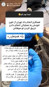 نمونه کار تزریق پی آر پی کلینیک رز سفید در ساری