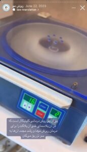 نمونه کار تزریق پی آر پی کلینیک رز سفید در ساری