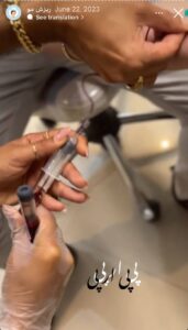 نمونه کار تزریق پی آر پی کلینیک رز سفید در ساری