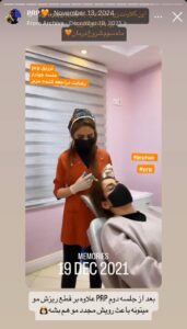 نمونه کار پی آر پی کلینیک گالیا در ساری