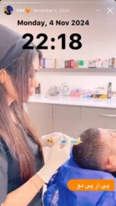 نمونه کار پی آر پی کلینیک گالیا در ساری