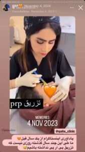 نمونه کار پی آر پی کلینیک گالیا در ساری