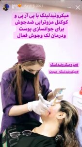 نمونه کار پی آر پی کلینیک گالیا در ساری