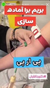 نمونه کار تزریق پی آر پی دکتر قلیان در ساری