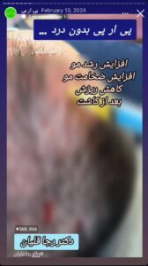 نمونه کار تزریق پی آر پی دکتر قلیان در ساری