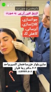 نمونه کار تزریق پی آر پی دکتر قلیان در ساری