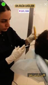 نمونه کار تزریق پی آر پی دکتر قلیان در ساری