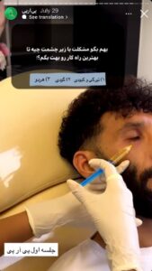 نمونه کار تزریق پی آر پی دکتر ابراهیمی در ساری