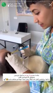 نمونه کار تزریق پی آر پی دکتر ابراهیمی در ساری