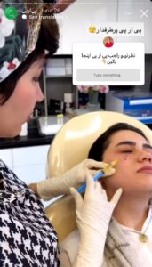 نمونه کار تزریق پی آر پی دکتر ابراهیمی در ساری