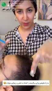 نمونه کار تزریق پی آر پی دکتر ابراهیمی در ساری