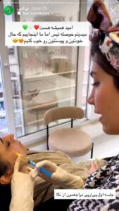 نمونه کار تزریق پی آر پی دکتر ابراهیمی در ساری