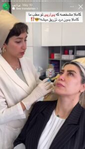 نمونه کار تزریق پی آر پی دکتر ابراهیمی در ساری