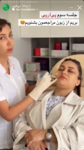 نمونه کار تزریق پی آر پی دکتر ابراهیمی در ساری