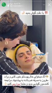 نمونه کار تزریق پی آر پی دکتر ابراهیمی در ساری