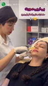 نمونه کار تزریق پی آر پی دکتر ابراهیمی در ساری