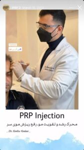 نمونه کار تزریق پی آر پی دکتر اسلامی در ساری