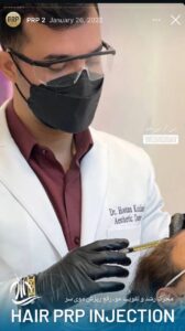 نمونه کار تزریق پی آر پی دکتر اسلامی در ساری