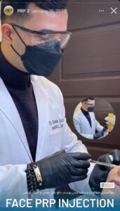 نمونه کار تزریق پی آر پی دکتر اسلامی در ساری