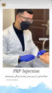 نمونه کار تزریق پی آر پی دکتر اسلامی در ساری