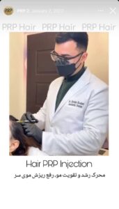 نمونه کار تزریق پی آر پی دکتر اسلامی در ساری