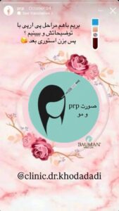 نمونه کار تزریق پی آر پی دکتر خدادادی در ساری