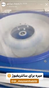 نمونه کار تزریق پی آر پی دکتر حبیبی در ساری