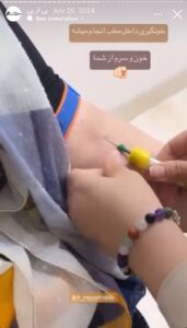 نمونه کار تزریق پی آر پی دکتر حبیبی در ساری