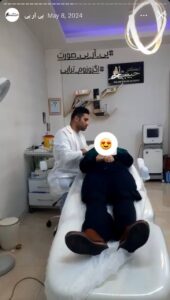 نمونه کار تزریق پی آر پی دکتر حبیبی در ساری