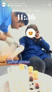 نمونه کار تزریق پی آر پی دکتر حبیبی در ساری