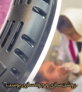 نمونه تزریق مزوژل کلینیک زیبایی الگانت