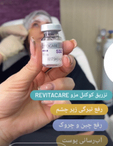 نمونه تزریق مزوژل کلینیک زیبایی الگانت