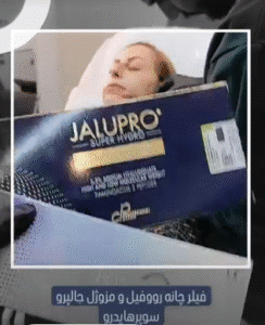 نمونه تزریق مزوژل کلینیک زیبایی الگانت