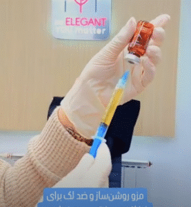 نمونه تزریق مزوژل کلینیک زیبایی الگانت