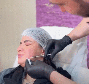 نمونه تزریق مزوژل کلینیک زیبایی الگانت