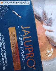 نمونه تزریق مزوژل دکتر زهره حاج حیدری (کلینیک پوست و مو صدف)