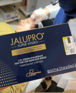 نمونه تزریق مزوژل دکتر زهره حاج حیدری (کلینیک پوست و مو صدف)