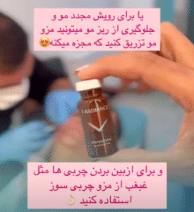 نمونه تزریق مزوژل کلینیک زیبایی برنا (دکتر شایان مهدی کیا)