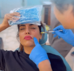 نمونه تزریق مزوژل کلینیک زیبایی برنا (دکتر شایان مهدی کیا)