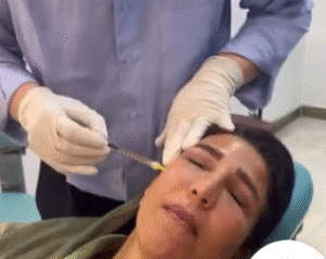 نمونه تزریق مزوژل کلینیک زیبایی برنا (دکتر شایان مهدی کیا)