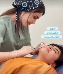 نمونه تزریق مزوژل دکتر گالیا رنجبر