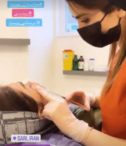 نمونه تزریق مزوژل دکتر گالیا رنجبر