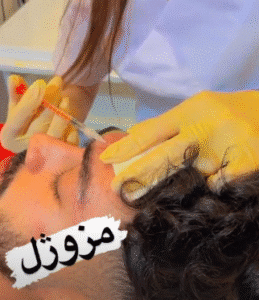 نمونه تزریق مزوژل دکتر گالیا رنجبر